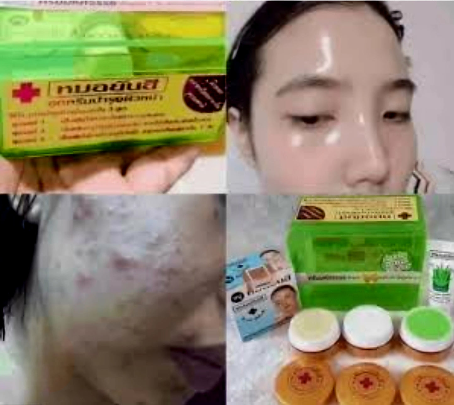 Dr.YAHNEE Anti-Acne Set (GREEN) Acne Remover
