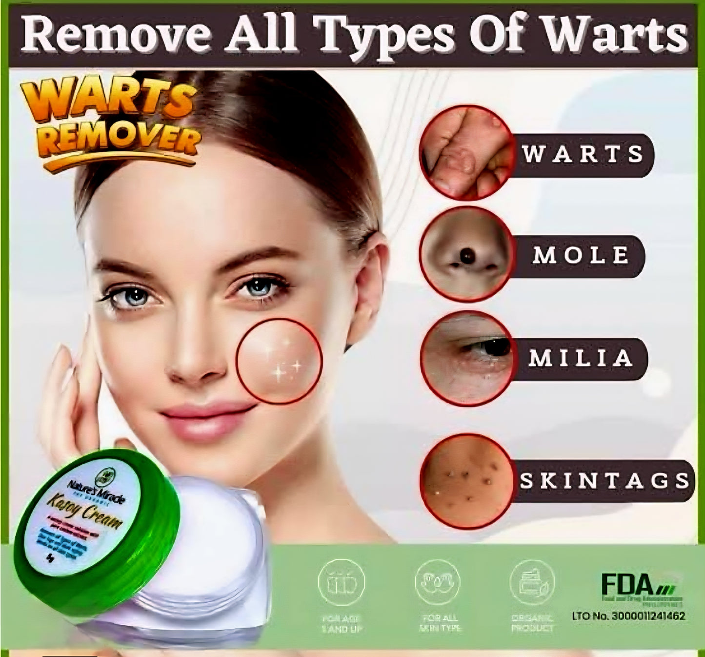 Nature's Miracle KASOY CREAM Warts & Skin Tags Removal 5g